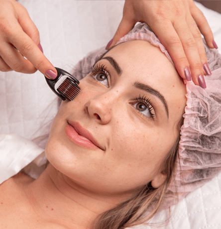 Microneedling Cosmetic Procedures
