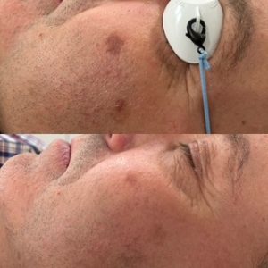 NadoLumeccaBeforeAndAfter
